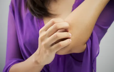 Vrouw krabt op elleboog