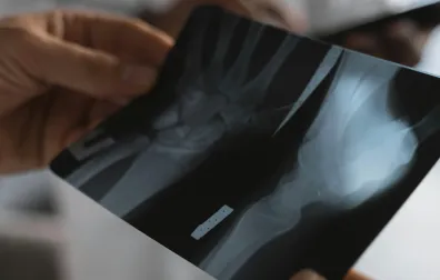 Röntgenfoto van botten en gewrichten